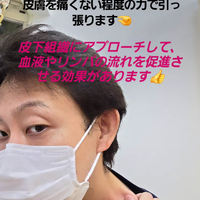 画像314